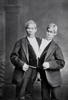 Chang and Eng Bunker, the original siamese twins