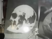 Andrew Borden Skull