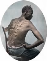 Thumbnail for 330px-Gordon,_scourged_back,_colored_slide_2.png