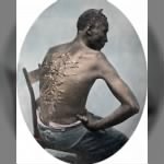 330px-Gordon,_scourged_back,_colored_slide_2.png